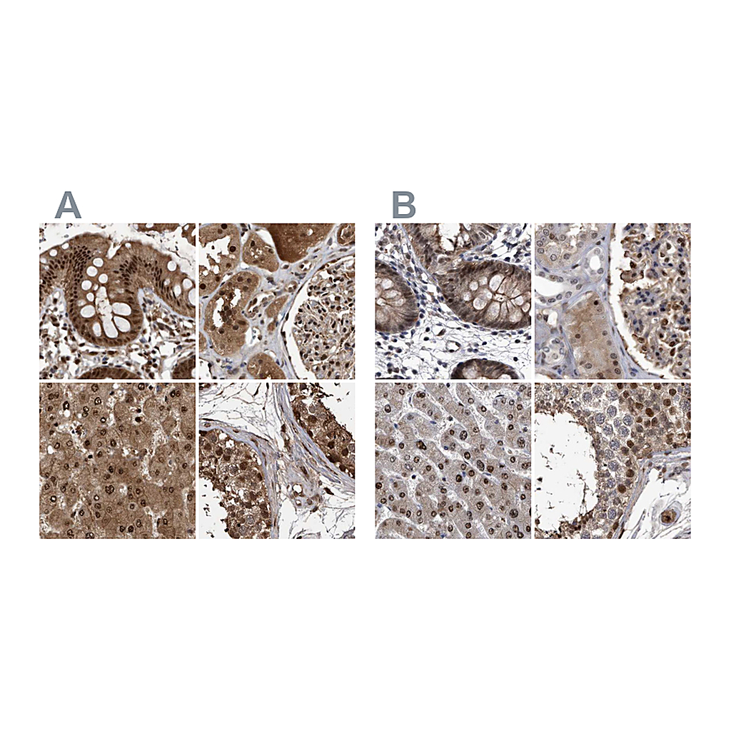 Atlas Antibodies Anti-RAD23B Antibody