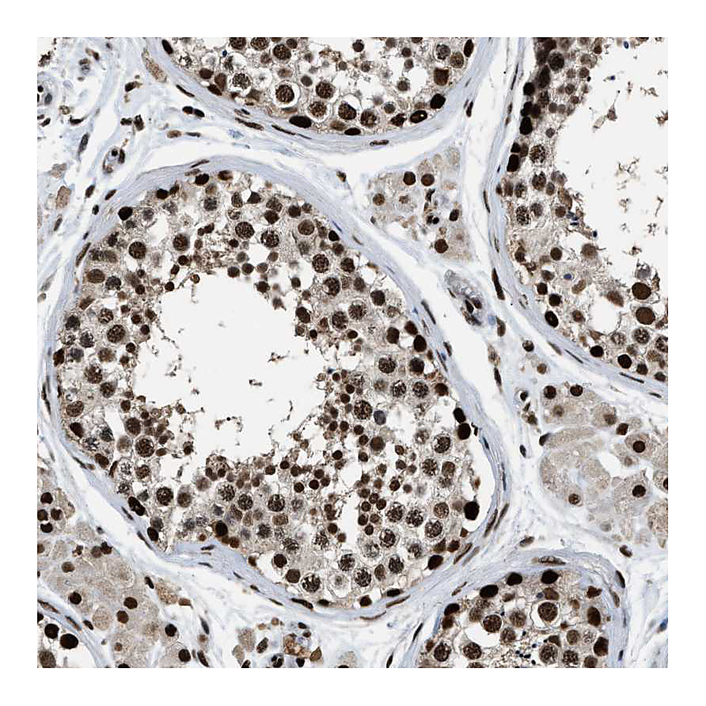 Atlas Antibodies Anti-RAD21 Antibody