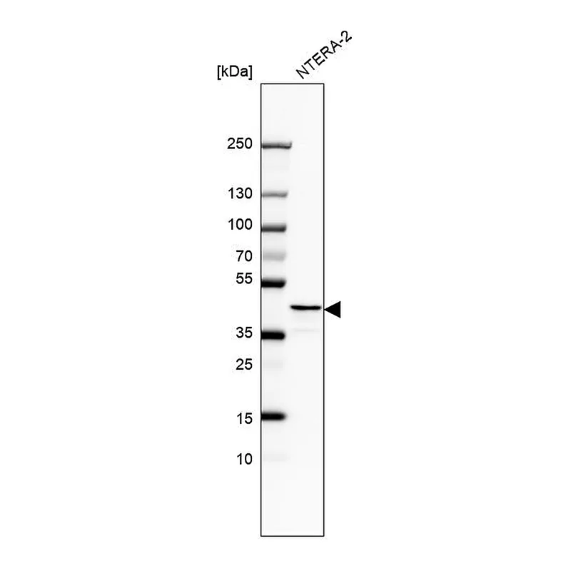 Atlas Antibodies Anti-RAD51AP1 Antibody