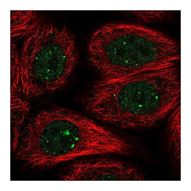 Atlas Antibodies Anti-RAD51B Antibody