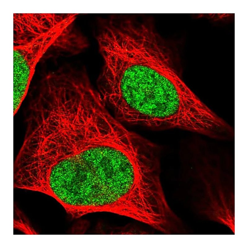 Atlas Antibodies Anti-RAD54L Antibody