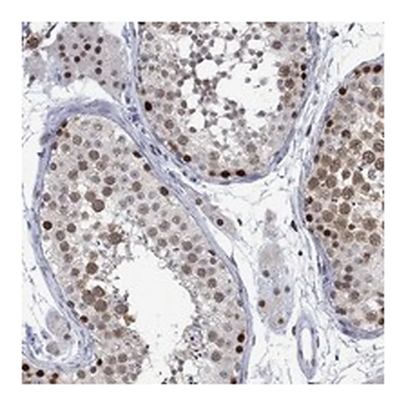 Atlas Antibodies Anti-RAD54L2 Antibody
