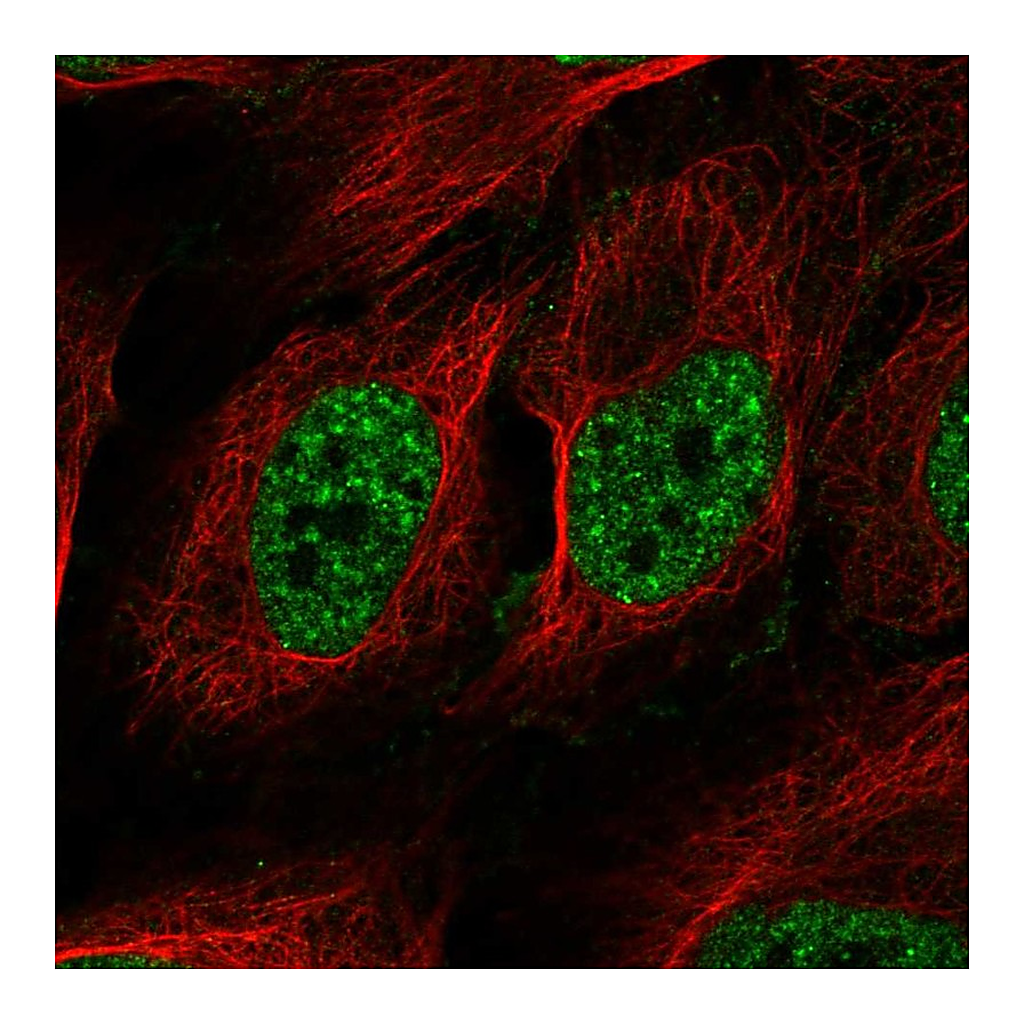 Atlas Antibodies Anti-RAD52 Antibody