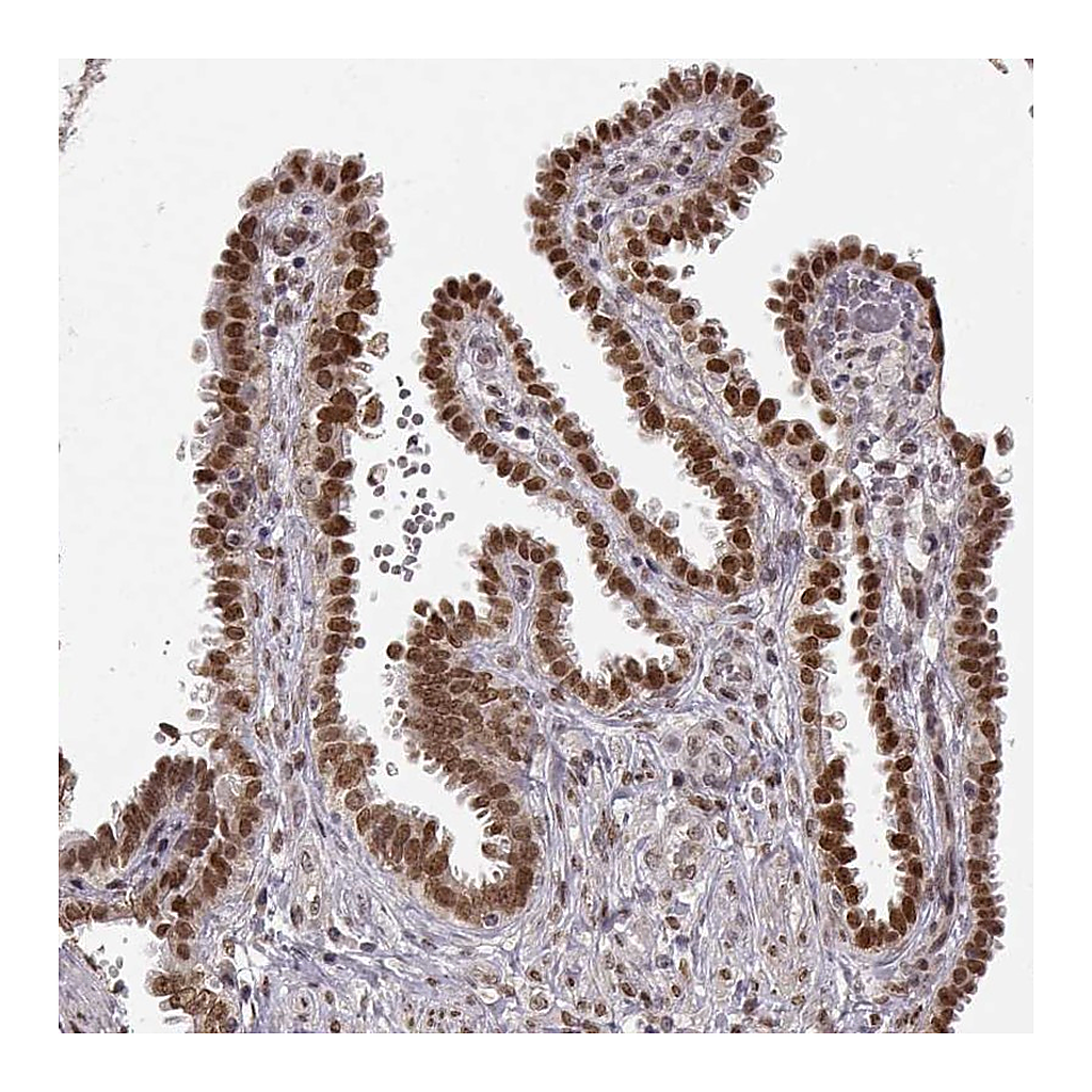 Atlas Antibodies Anti-RAI1 Antibody
