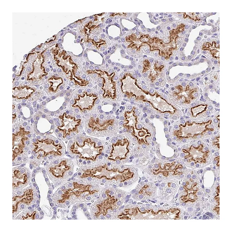 Atlas Antibodies Anti-RADIL Antibody