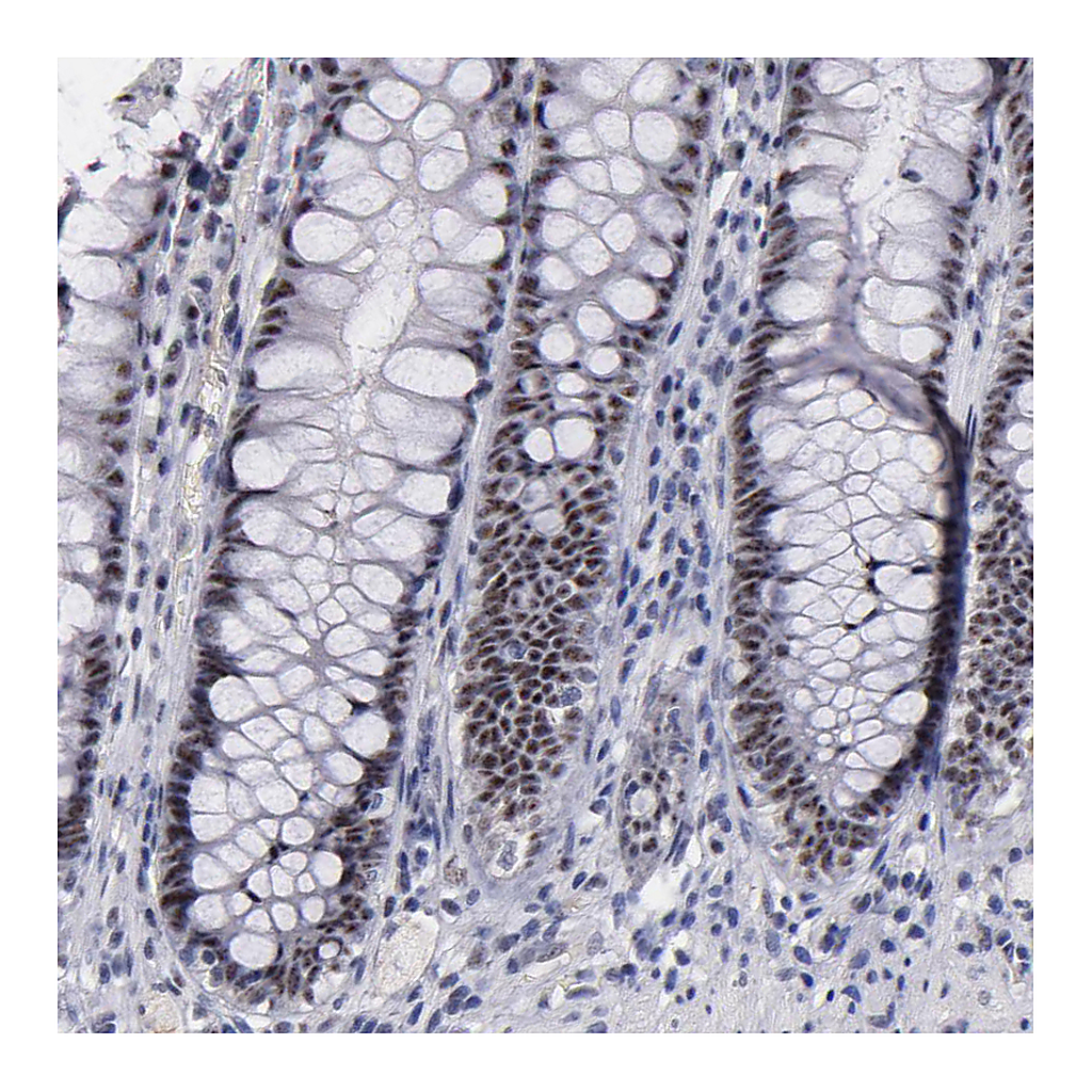 Atlas Antibodies Anti-RAF1 Antibody