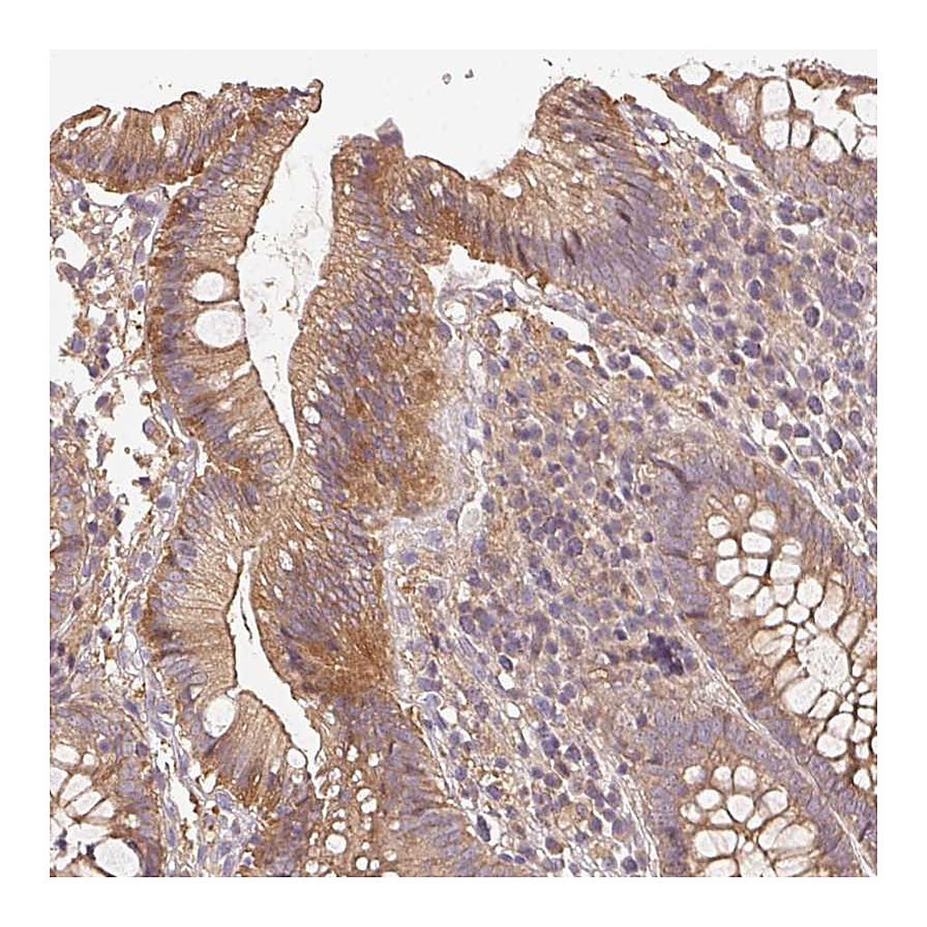 Atlas Antibodies Anti-RALA Antibody