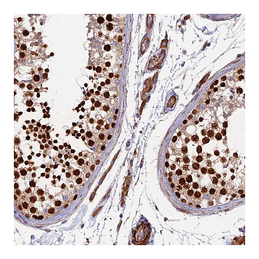 Atlas Antibodies Anti-RALGAPA2 Antibody