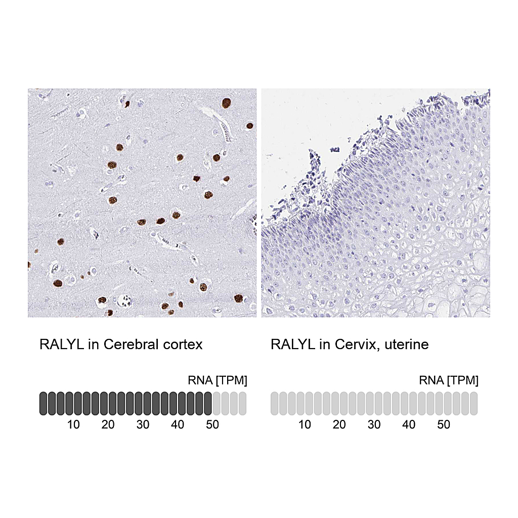 Atlas Antibodies Anti-RALYL Antibody