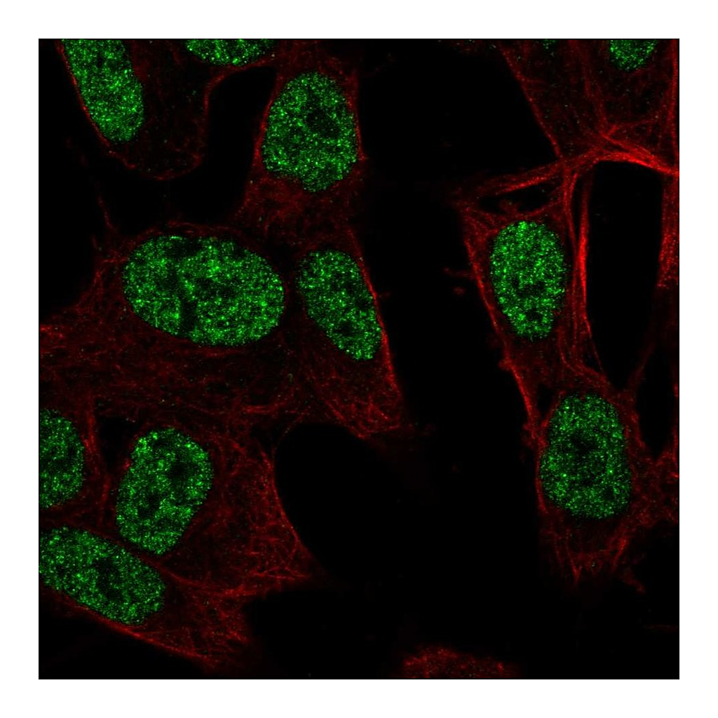 Atlas Antibodies Anti-RALYL Antibody
