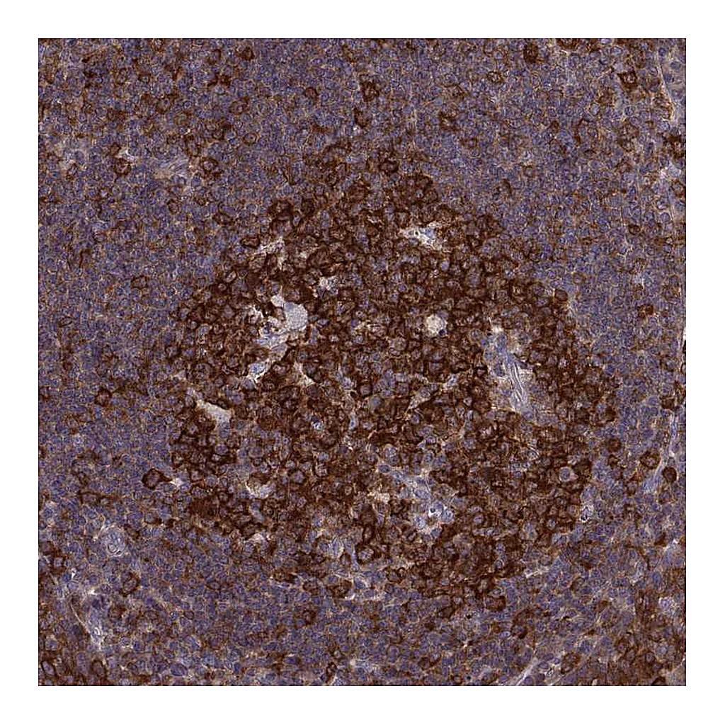 Atlas Antibodies Anti-RANBP1 Antibody