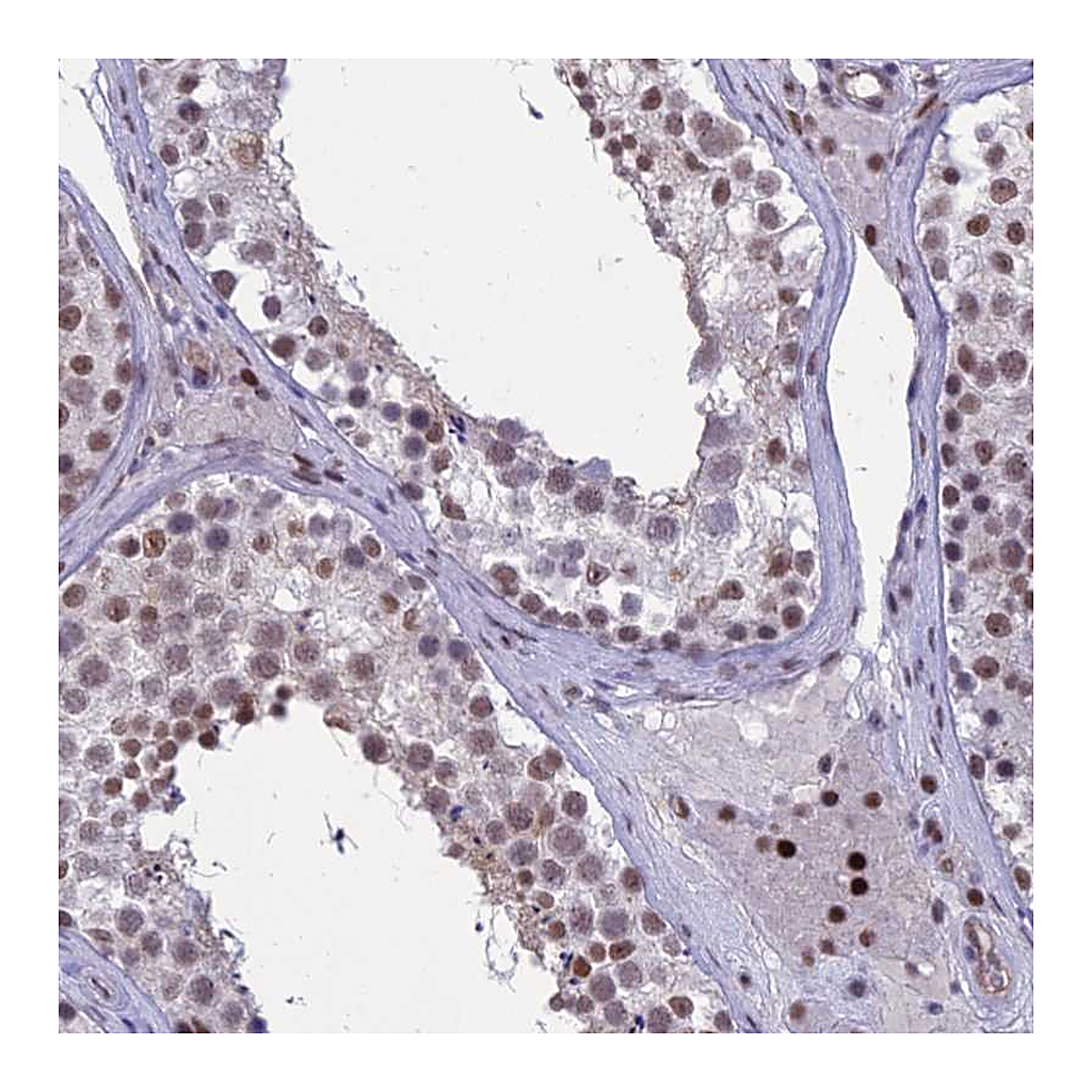 Atlas Antibodies Anti-RANBP3 Antibody