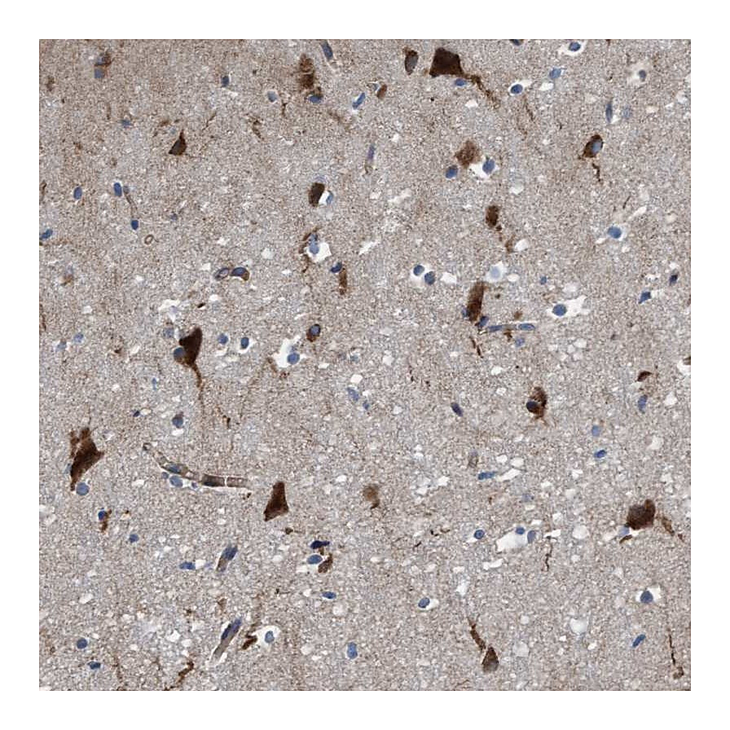 Atlas Antibodies Anti-RAP1GAP2 Antibody
