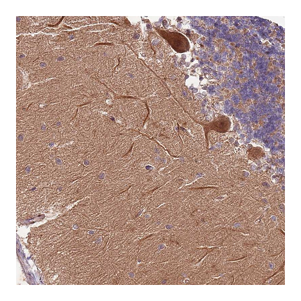 Atlas Antibodies Anti-RAPGEF3 Antibody