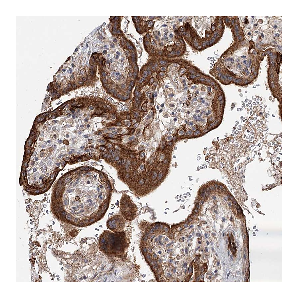 Atlas Antibodies Anti-RAPGEF6 Antibody
