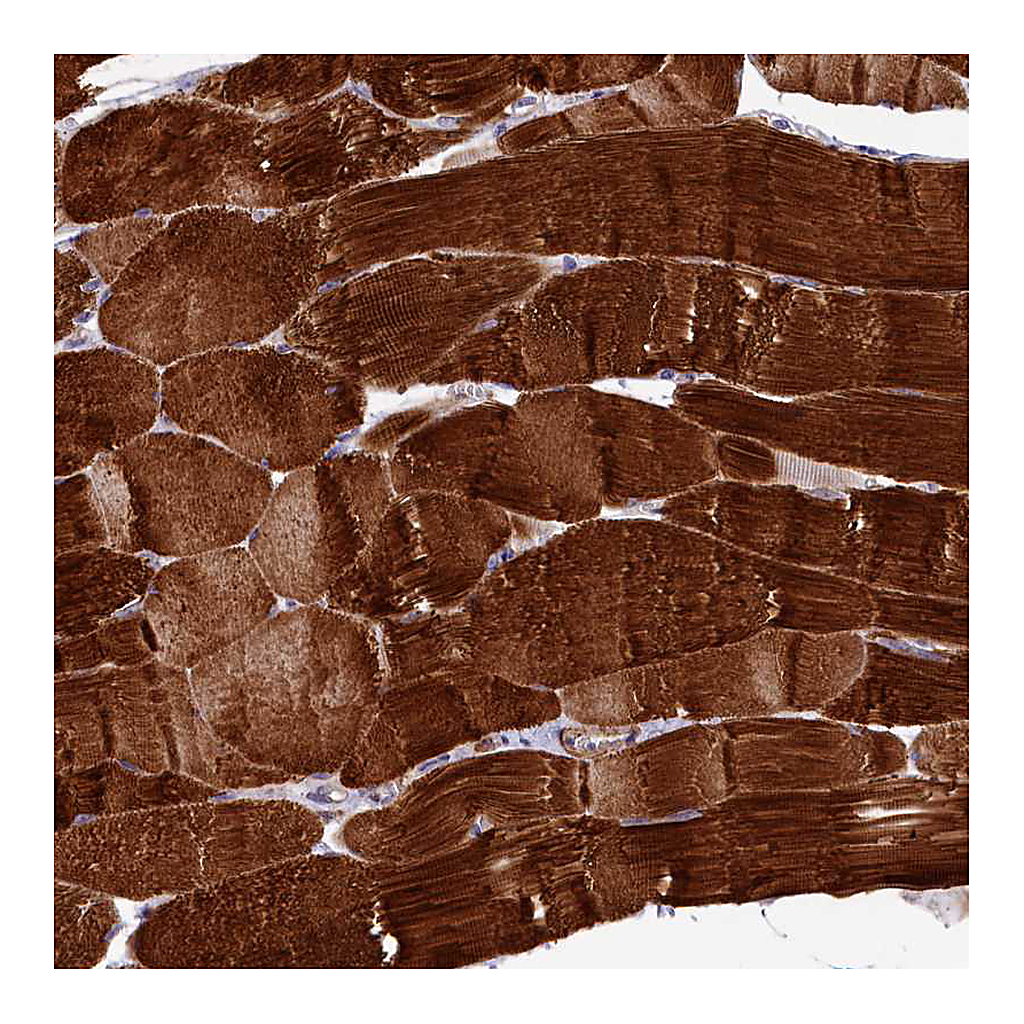 Atlas Antibodies Anti-RAPSN Antibody