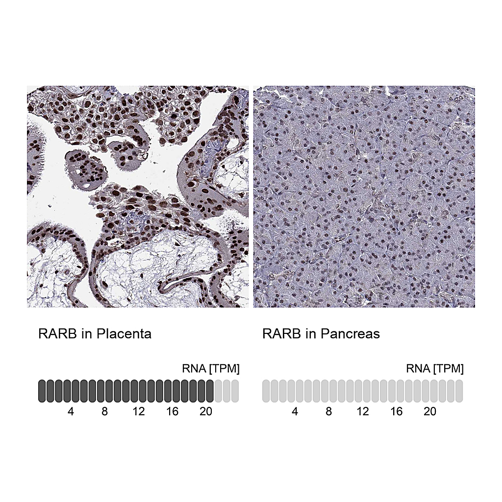 Atlas Antibodies Anti-RARB Antibody