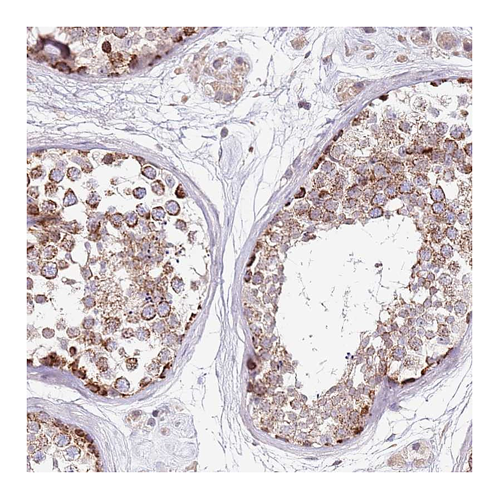 Atlas Antibodies Anti-RARS2 Antibody