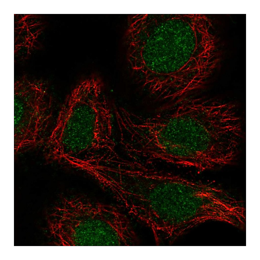 Atlas Antibodies Anti-RARA Antibody