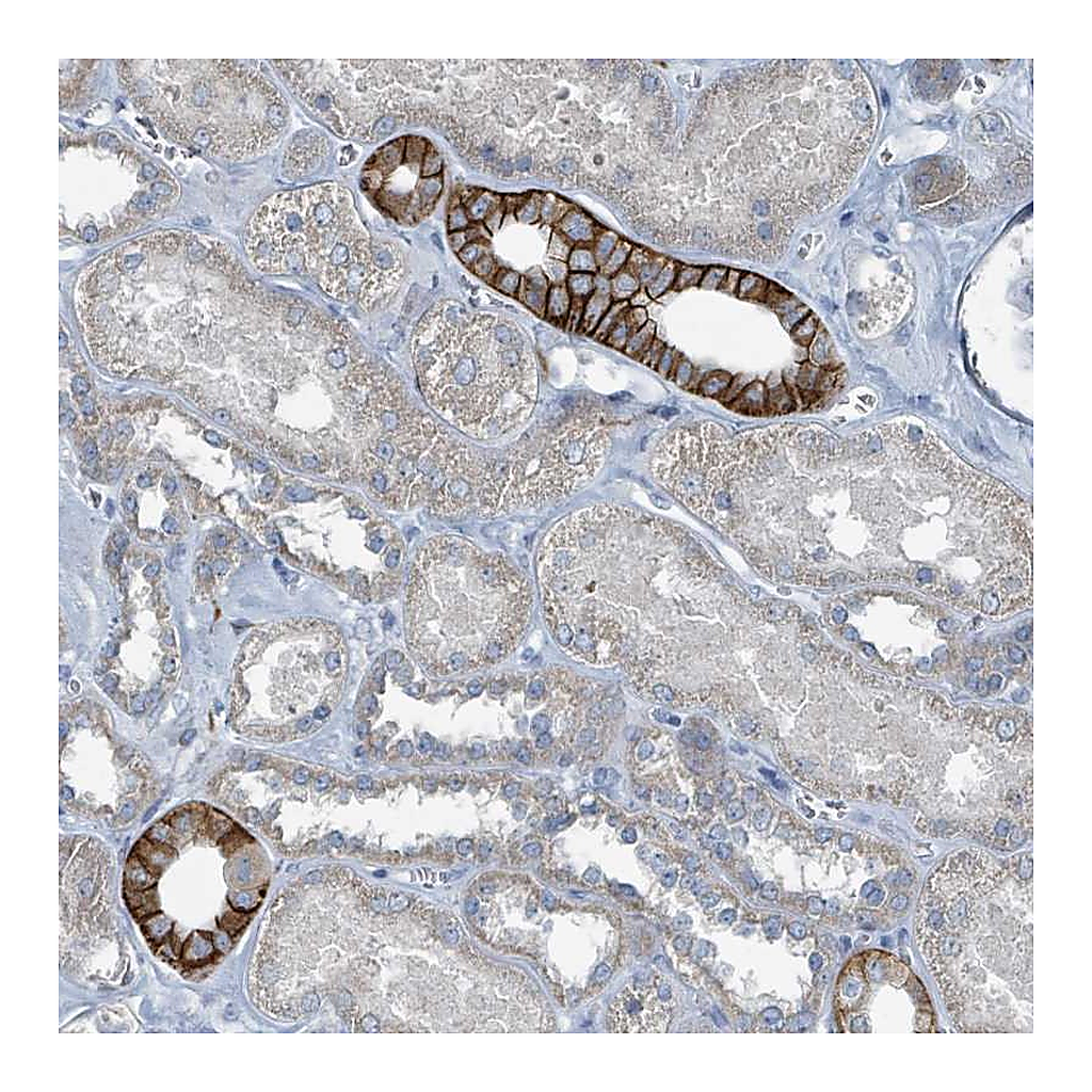 Atlas Antibodies Anti-RASA4 Antibody