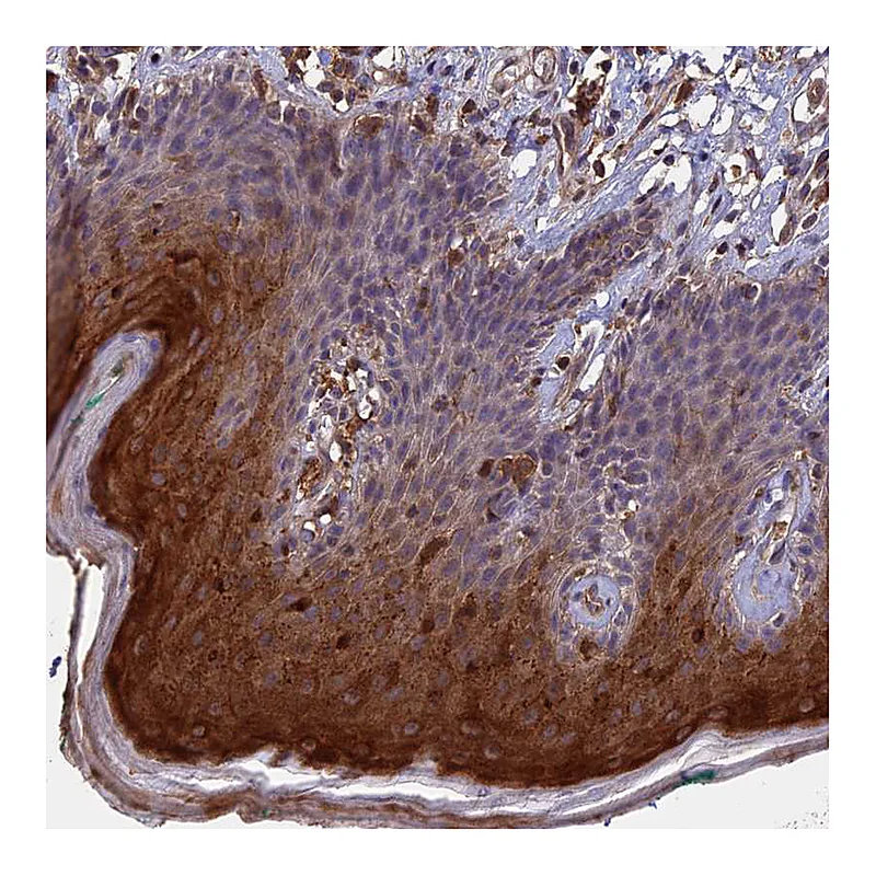 Atlas Antibodies Anti-RASAL1 Antibody
