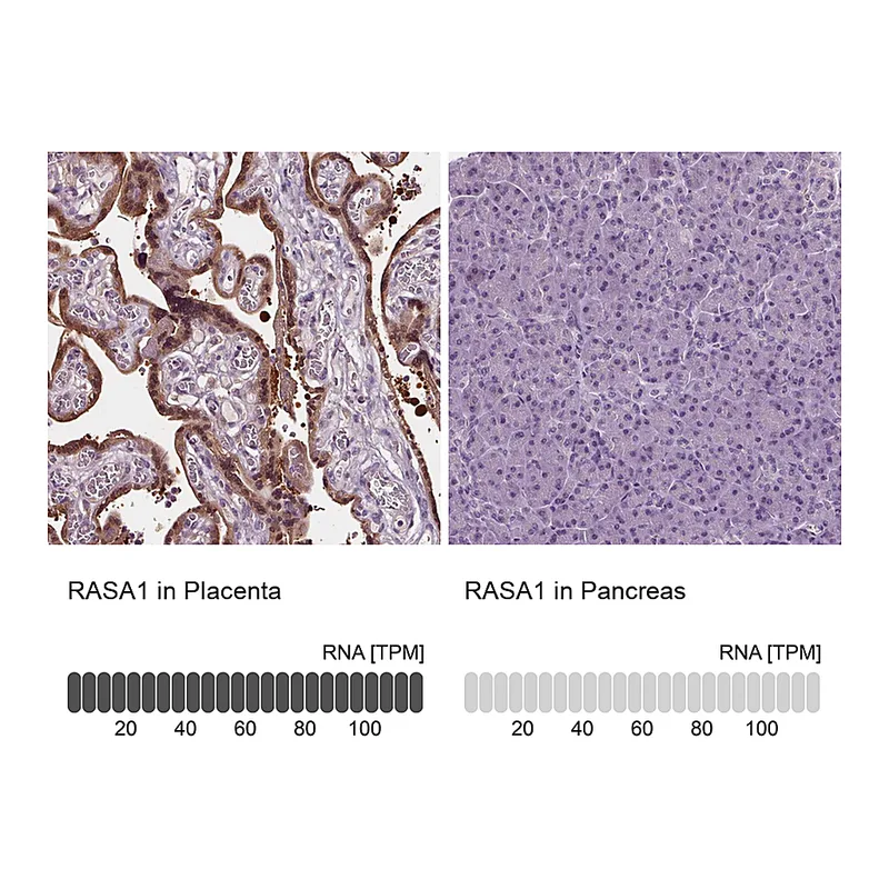 Atlas Antibodies Anti-RASA1 Antibody