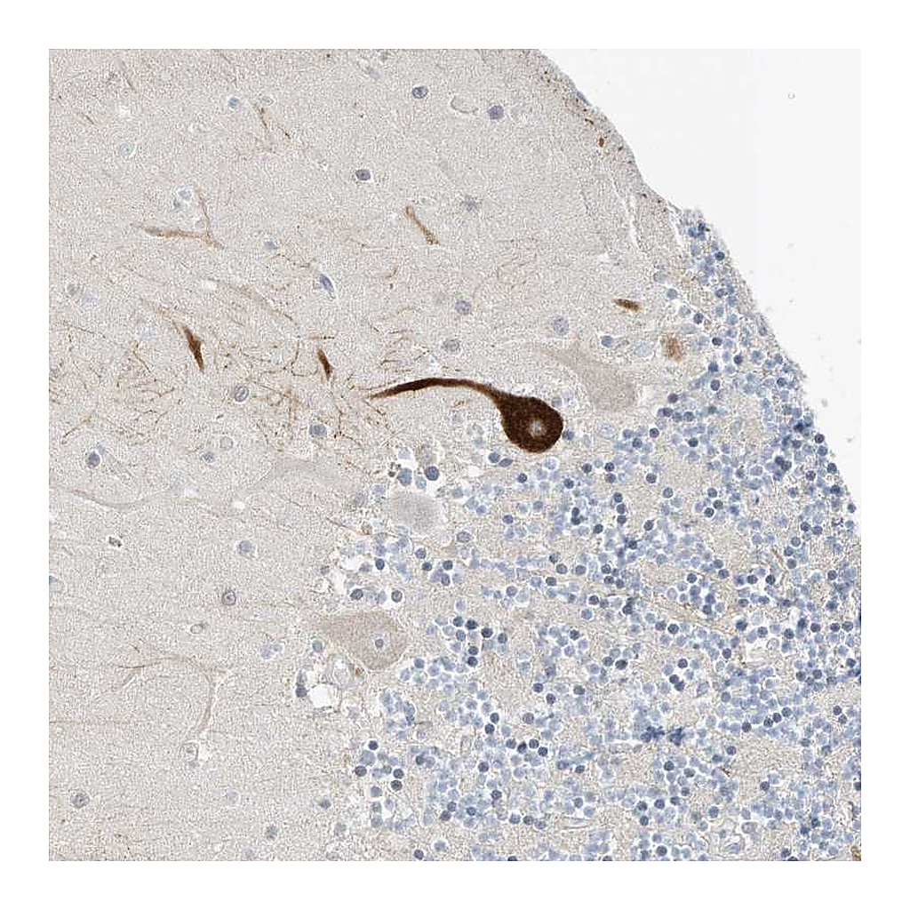 Atlas Antibodies Anti-RASA2 Antibody
