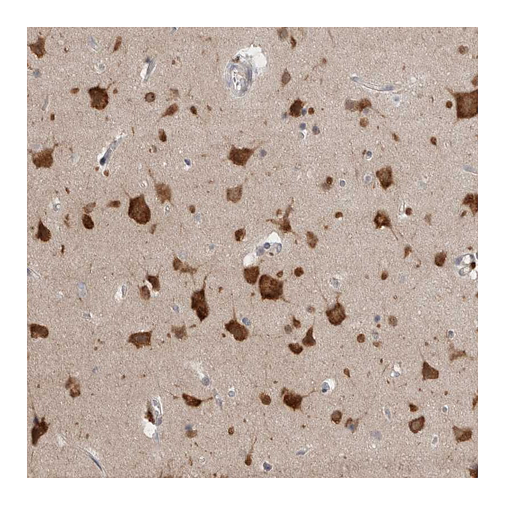 Atlas Antibodies Anti-RASAL2 Antibody