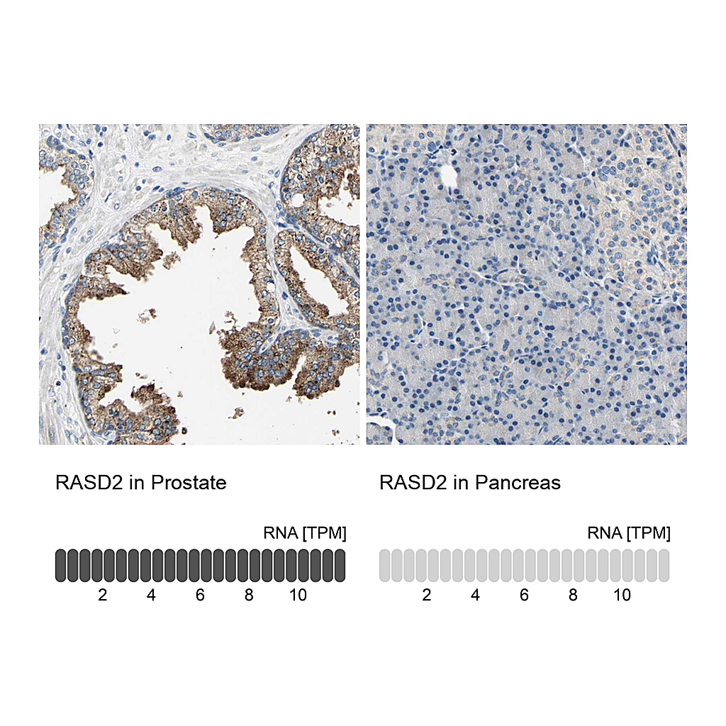 Atlas Antibodies Anti-RASD2 Antibody