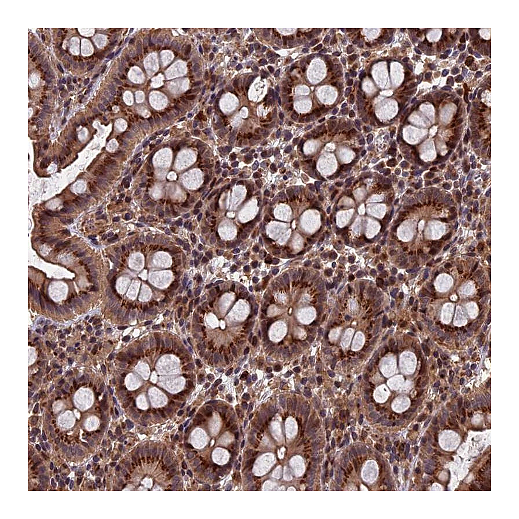 Atlas Antibodies Anti-RASGRF1 Antibody