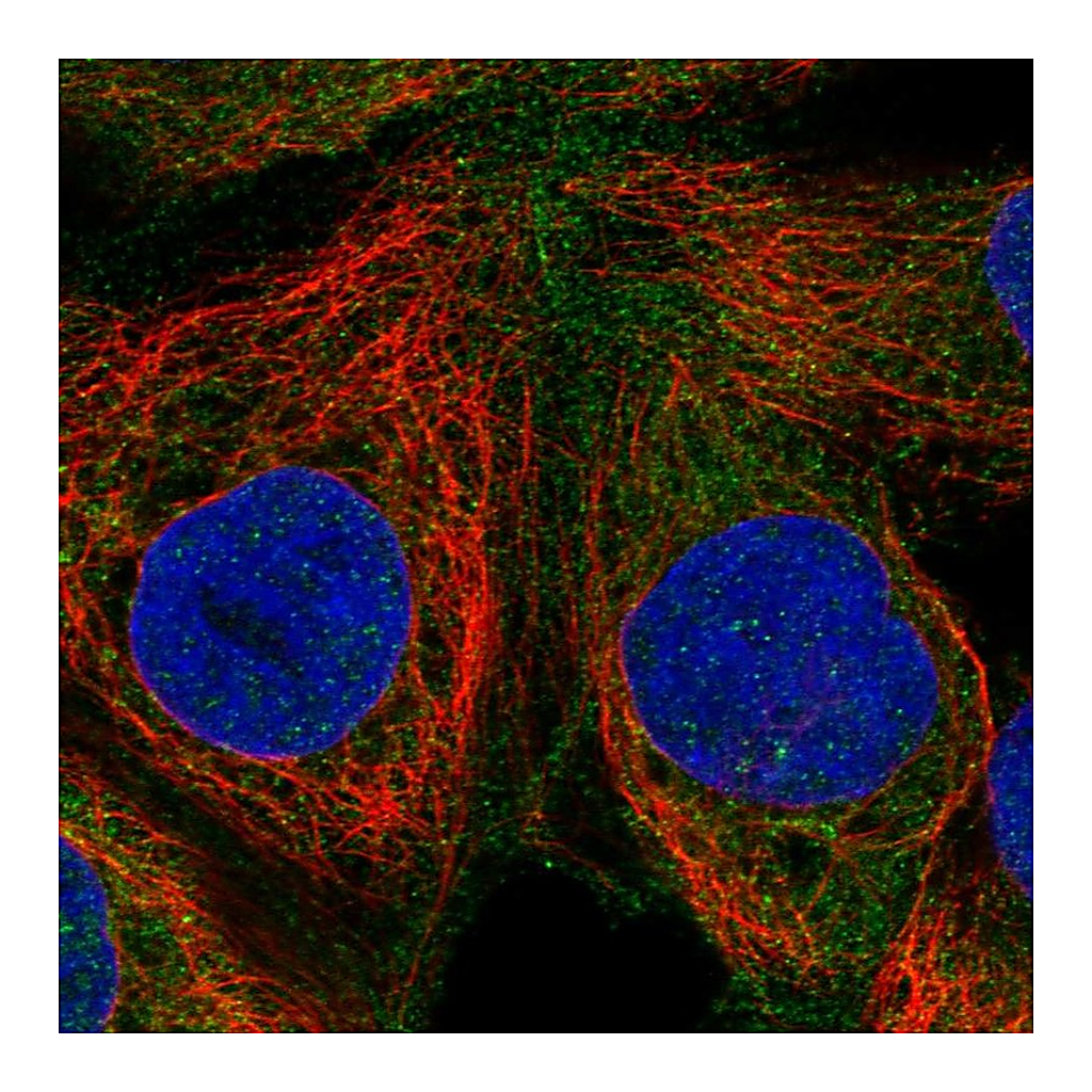 Atlas Antibodies Anti-RASGRP1 Antibody