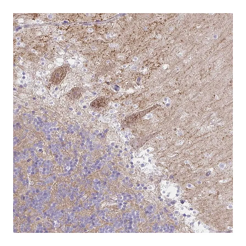 Atlas Antibodies Anti-RASL10A Antibody