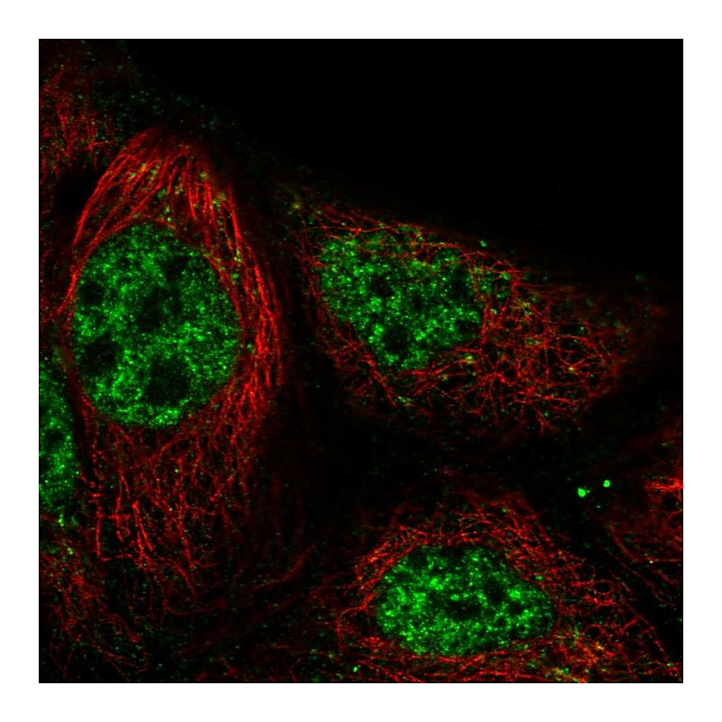 Atlas Antibodies Anti-RASGRP3 Antibody