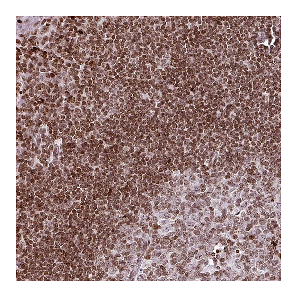 Atlas Antibodies Anti-RASL11A Antibody