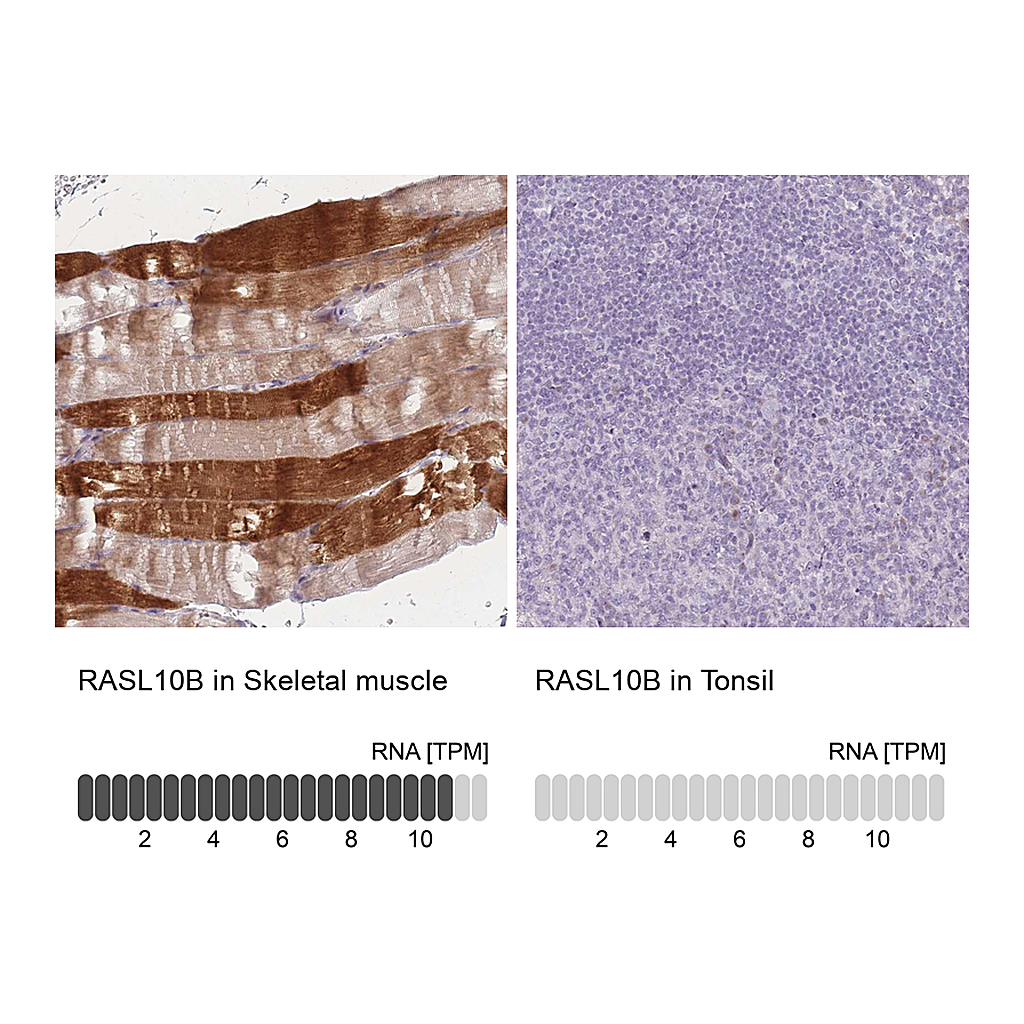 Atlas Antibodies Anti-RASL10B Antibody