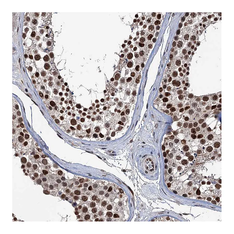 Atlas Antibodies Anti-RASSF4 Antibody