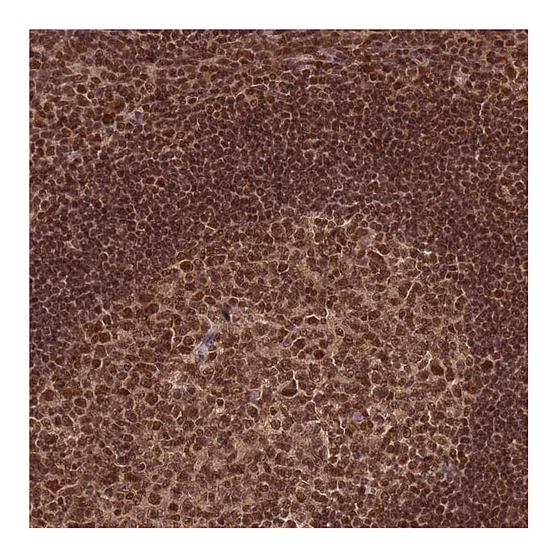 Atlas Antibodies Anti-RAVER1 Antibody