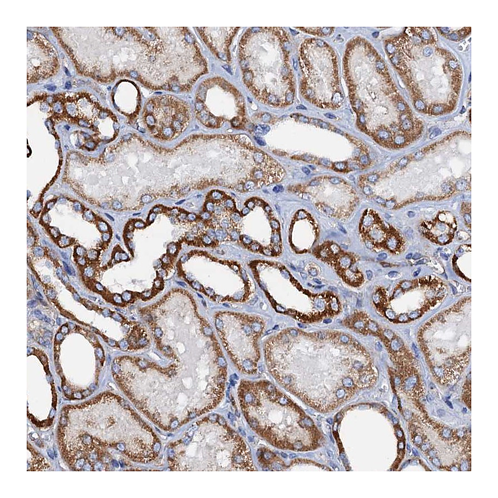 Atlas Antibodies Anti-RASSF9 Antibody