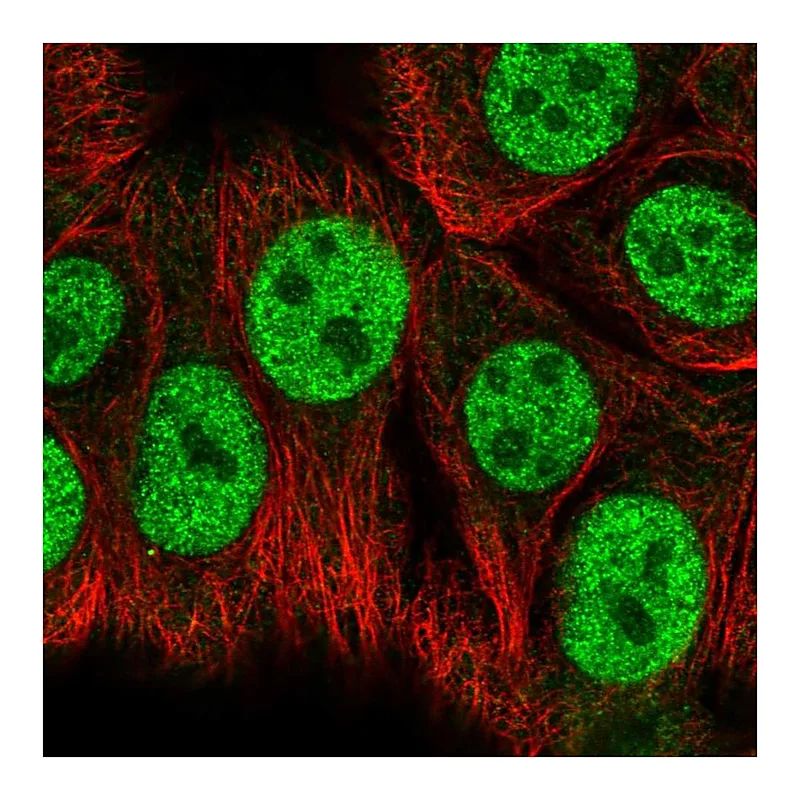 Atlas Antibodies Anti-RBAK Antibody