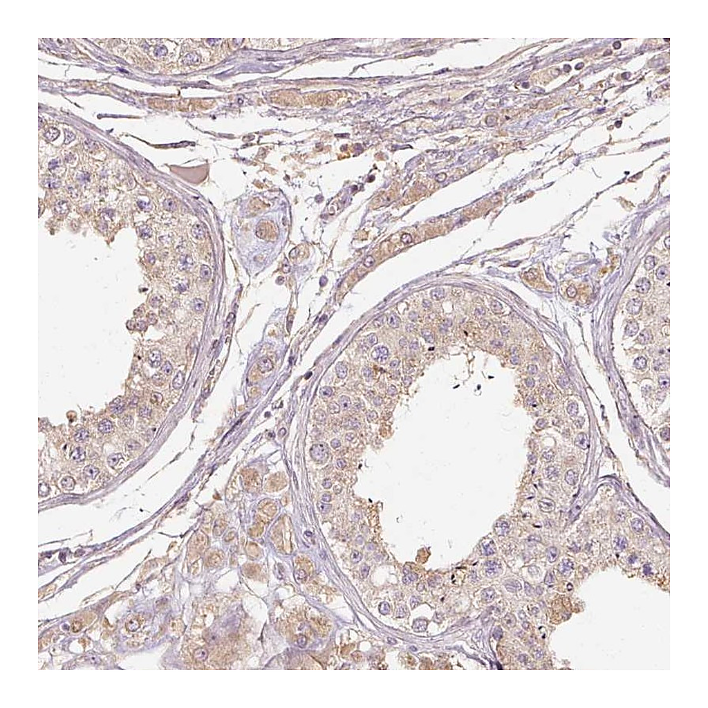 Atlas Antibodies Anti-RB1CC1 Antibody