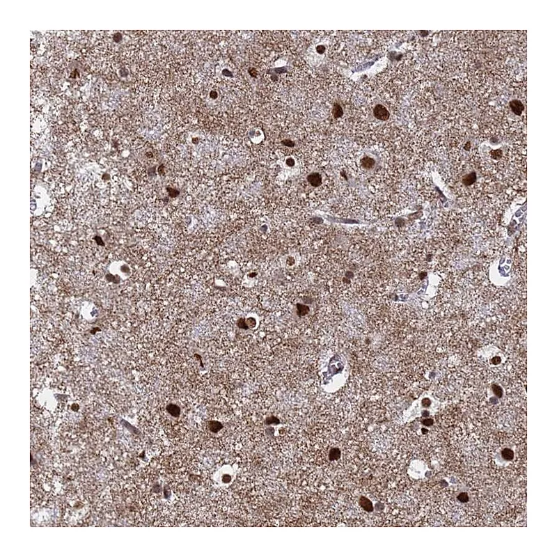 Atlas Antibodies Anti-RAVER2 Antibody