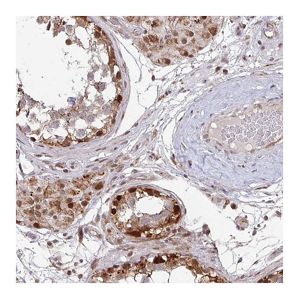 Atlas Antibodies Anti-RBBP5 Antibody