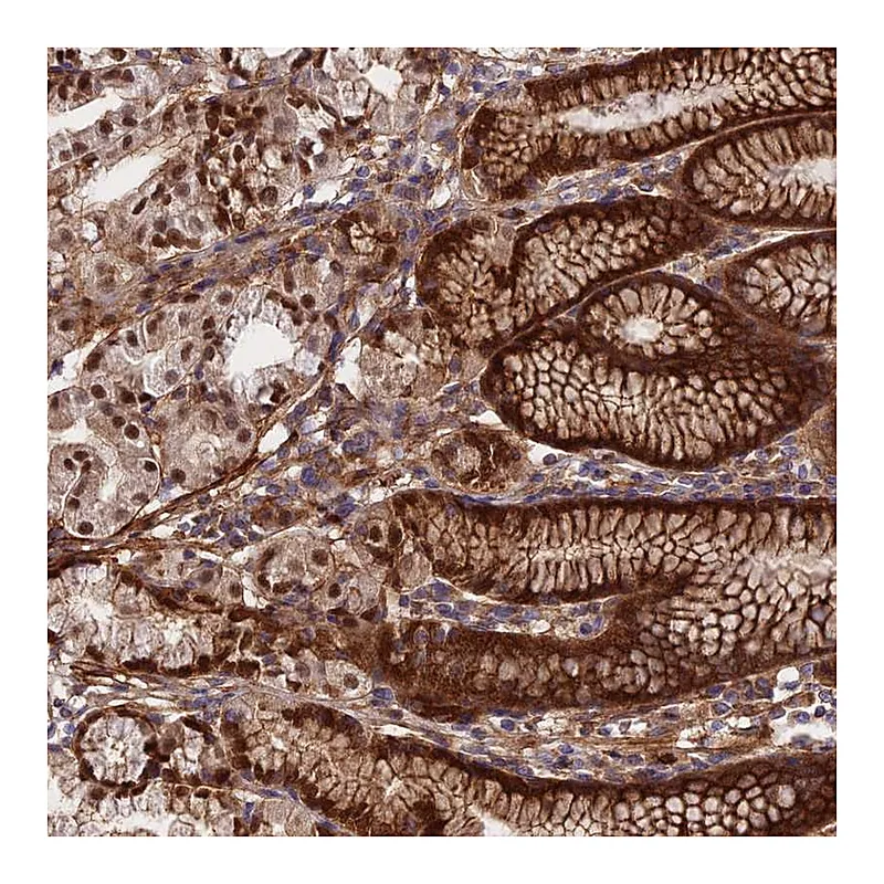 Atlas Antibodies Anti-RBBP8NL Antibody