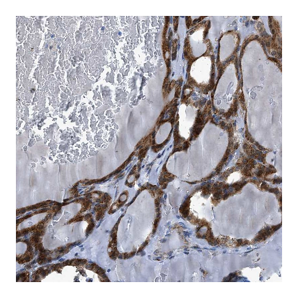 Atlas Antibodies Anti-RBBP9 Antibody