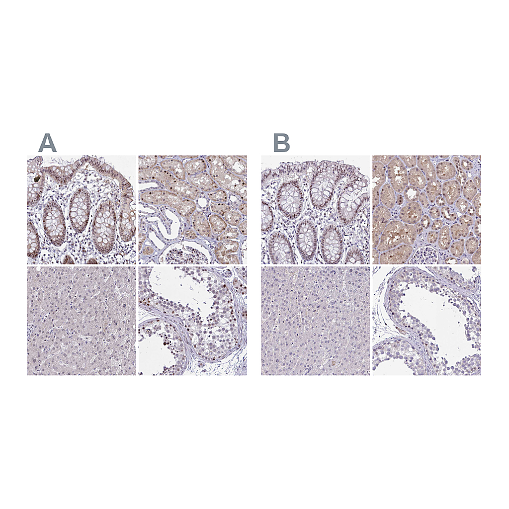 Atlas Antibodies Anti-RBL1 Antibody