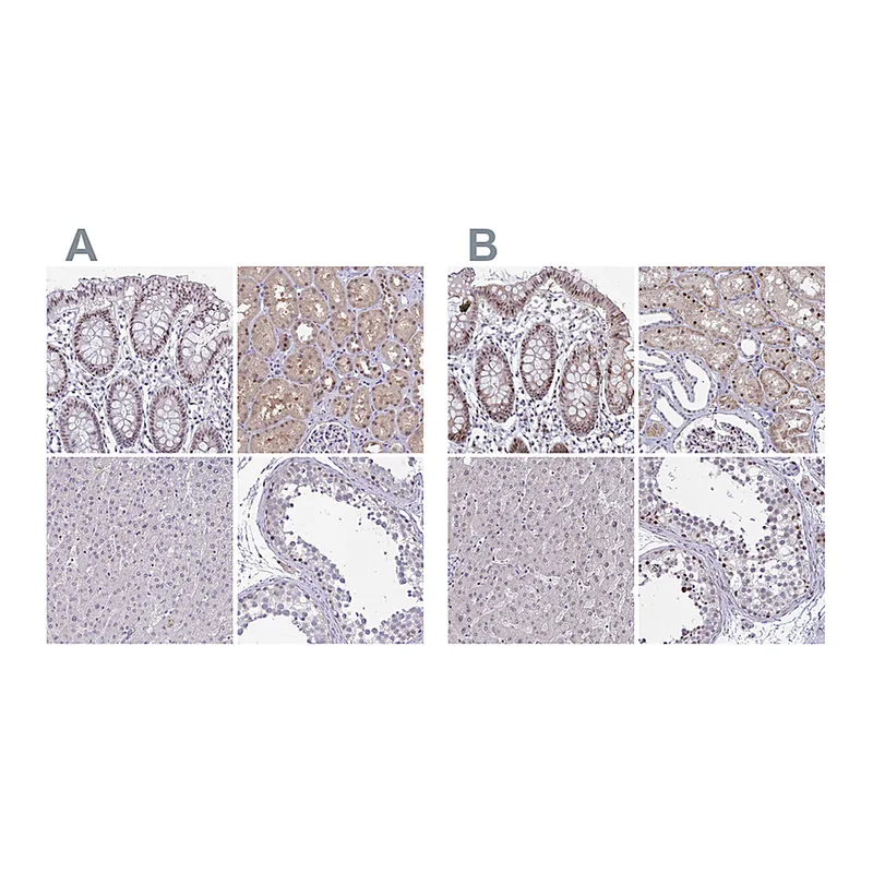 Atlas Antibodies Anti-RBL1 Antibody