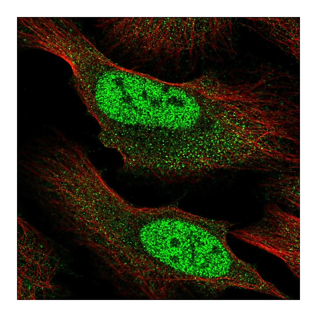Atlas Antibodies Anti-RBM12B Antibody