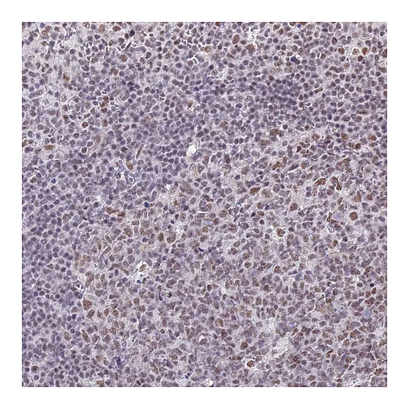 Atlas Antibodies Anti-RBM12 Antibody