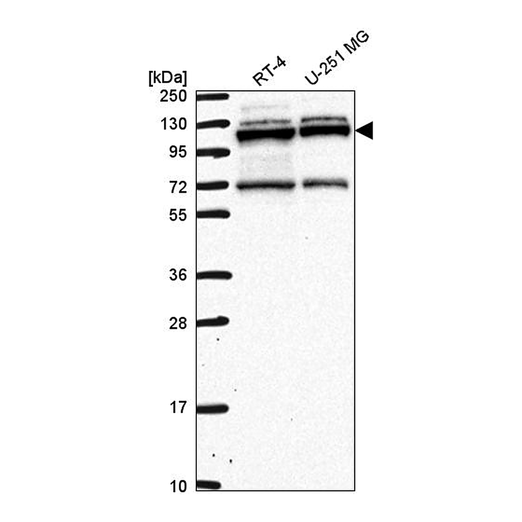 Atlas Antibodies Anti-RBM15 Antibody