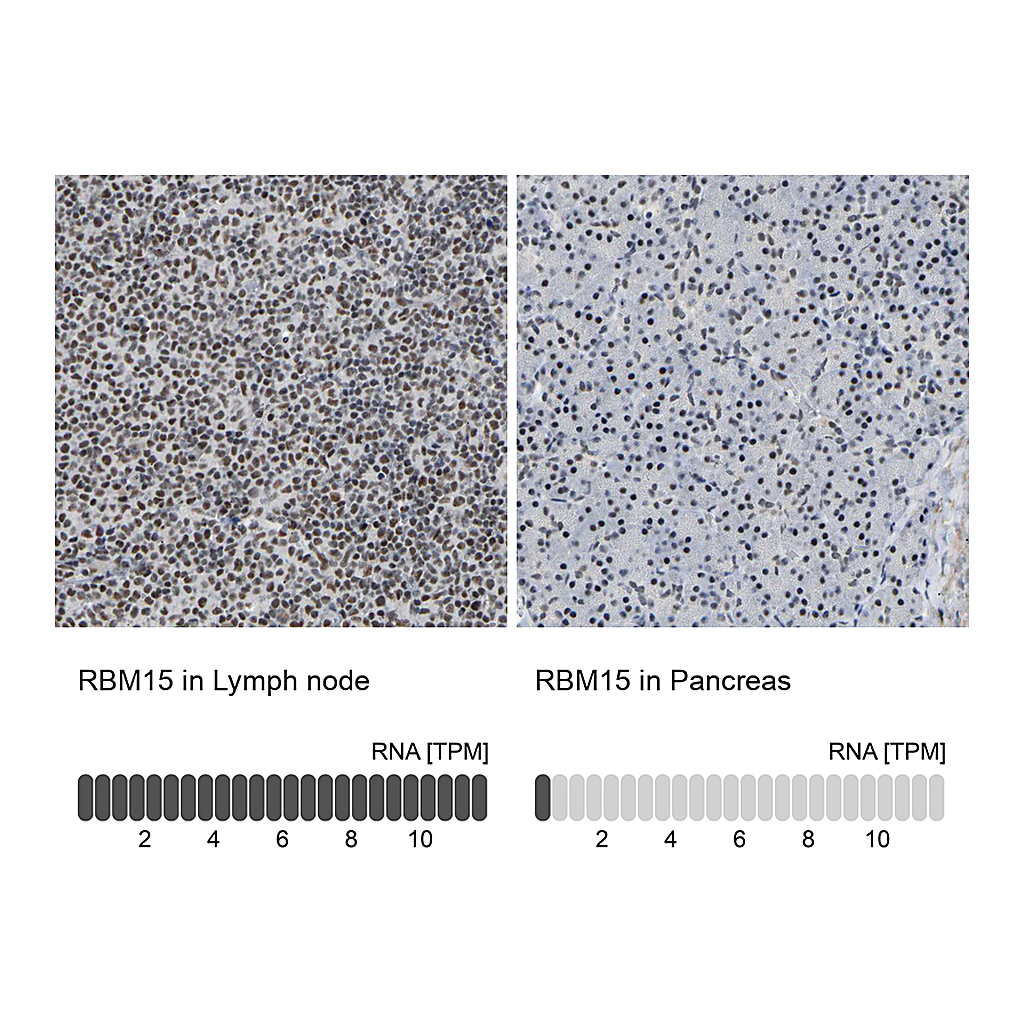 Atlas Antibodies Anti-RBM15 Antibody